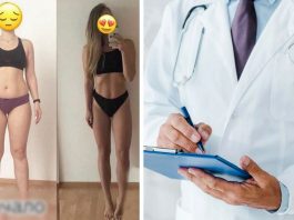 Чому люди не можуть схуднути: лікар назвав 8 помилок
